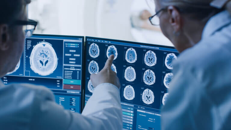 Doctors reviewing brain scan images on dual monitors